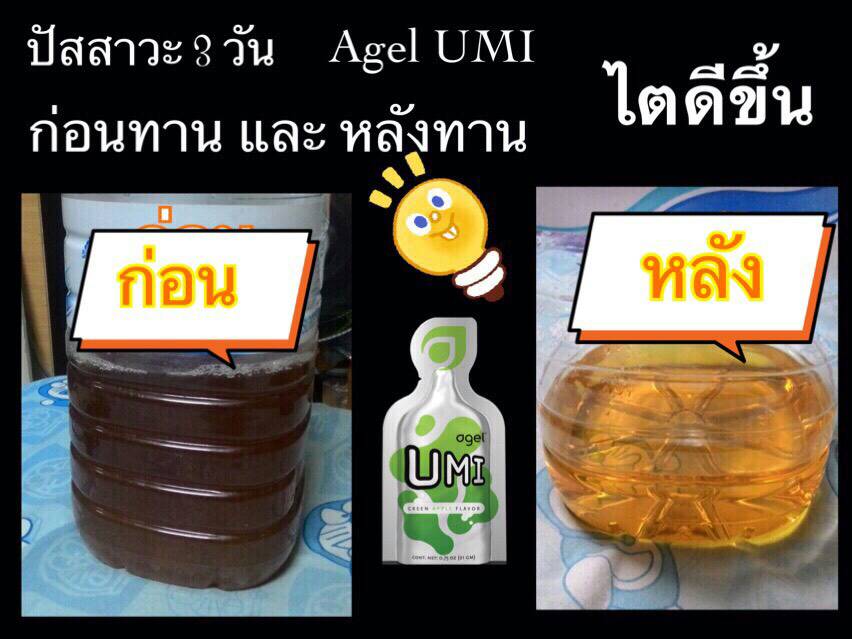 Urine Before-After